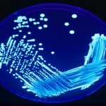 Bactéria Legionella. Colônias crescendo em uma placa de ágar e iluminado com luz ultravioleta para aumentar o contraste.